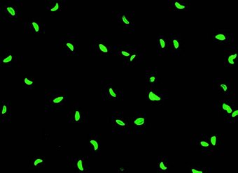 Antikörper gegen Toxoplasma gondii